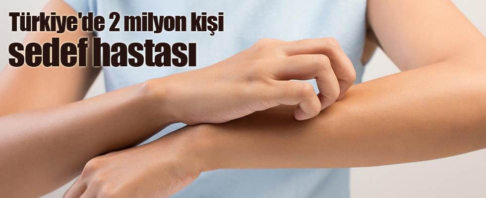 Türkiye'de 2 milyon kişi sedef hastası