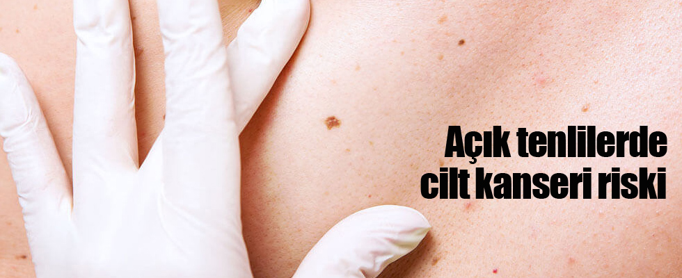 Açık tenlilerde cilt kanseri riski