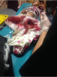 Kars'ta Patos Makinesine Düşen Kız Çocuğu Ağır Yaralandı