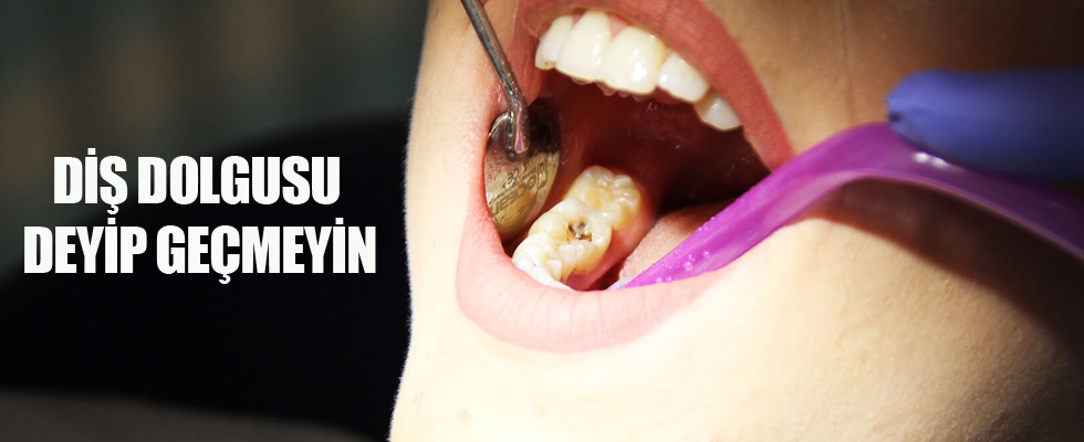 Diş dolgusu deyip geçmeyin