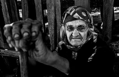 'Açık Tenlilerin Cildi Daha Çabuk Yaşlanıyor'