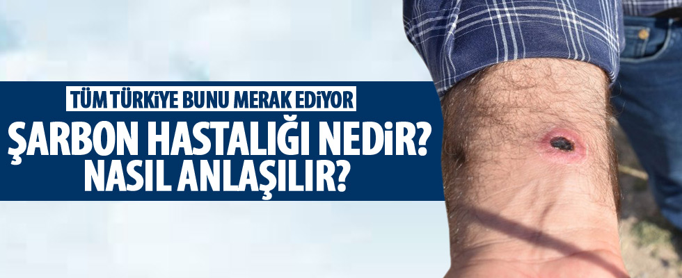 Şarbon hastalığı nedir?