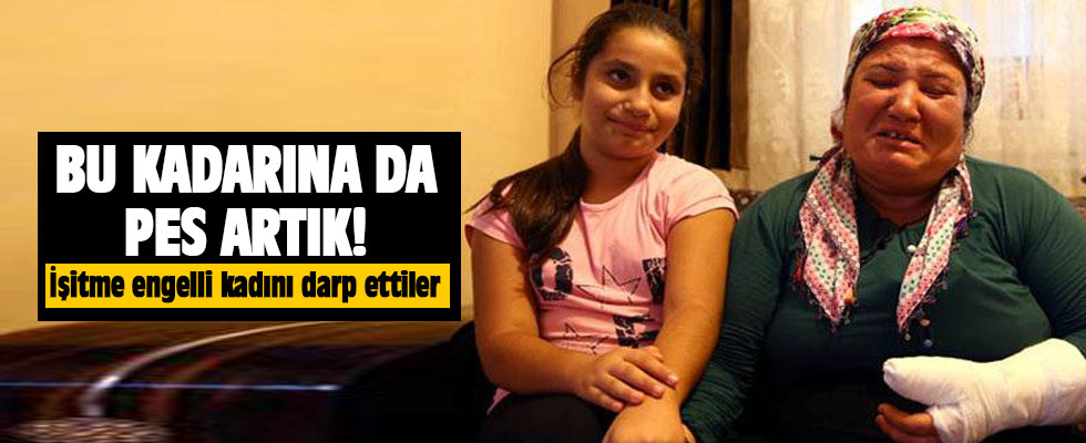 Bu kadarı da pes! İşitme engelli kadını bu hale getirdi