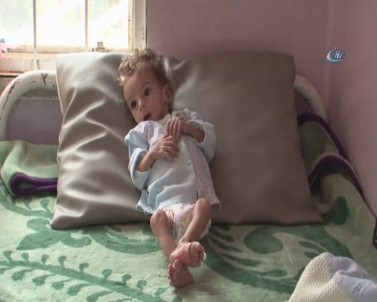 Yemen Kıtlık Tehlikesiyle Karşı Karşıya