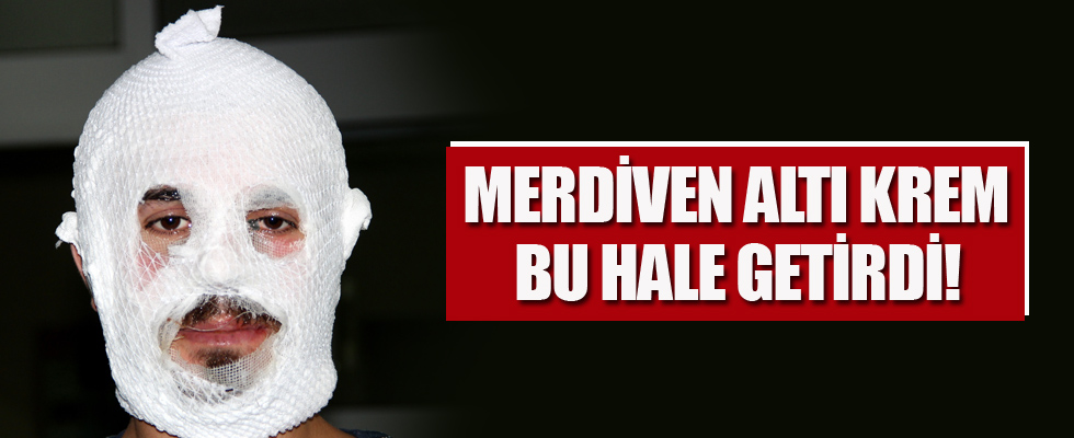 Merdiven altı krem bu hale getirdi