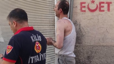 Kilis'te Ev Yangını Açıklaması 1 Yaralı