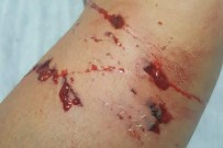 TOKI - Başı Boş Köpekler Öğrenciyi Hastanelik Etti