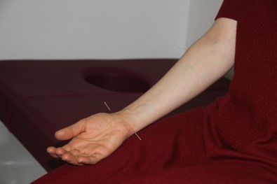Isparta Şehir Hastanesi'nde Akupunktur İle İlaçsız Tedavi Dönemi