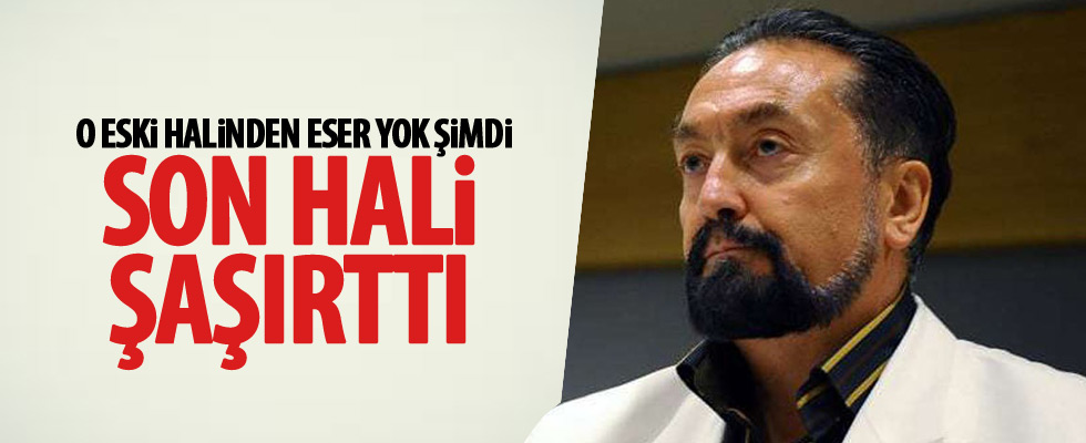 Adnan Oktar'ın son hali şaşırttı