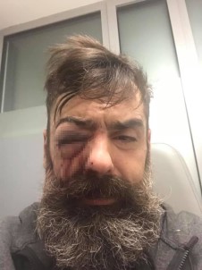 Sarı Yelekliler 11'İnci Kez Sokakta