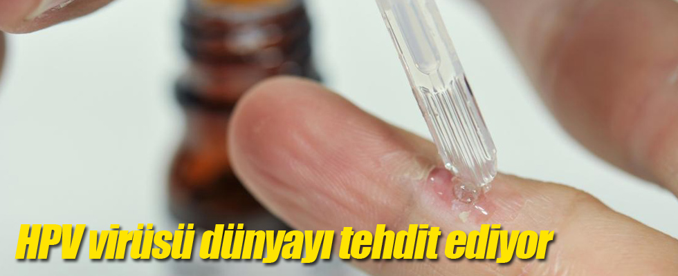 HPV virüsü dünyayı tehdit ediyor