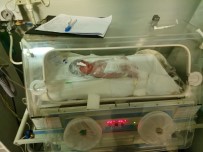 SAHRA HASTANESİ - Arakanlı İkizler Türk Hastanesinde Hayata Döndürüldü