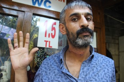 Olayda Ağır Yaralanan Tuvalet Bekçisi Konuştu