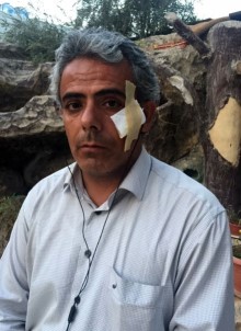 İHA Muhabiri Yaralandığı Roketli Saldırıyı Anlattı