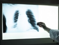 AŞIRI KİLOLU - Aşırı kiloluların akciğerlerinde astıma yol açan yağ dokusu tespit edildi