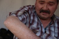 DINDAR - 'Balık Pulu' Hastalığı Vatandaşların Kabusu Oldu