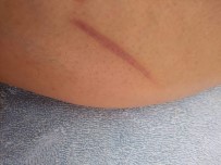 FLORIDA - Çocuklarını İstedi İşkence Gördü