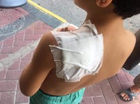 SOKAK KÖPEĞİ - Antalya'da İlkokul Öğrencisi, Okul Dönüşü Sokak Kopeğinin Saldırısına Uğradı