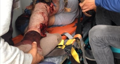 Feci Kaza Sonrası Bacağındaki Çapa Makinesi İle Hastaneye Kaldırıldı