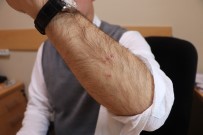 ADNAN MENDERES - Profesörü Köpek Isırdı, Ameliyatları Aksadı