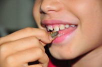 DIŞ HEKIMI - (Özel) Uyarı Çocuklar İçin Geldi Açıklaması 'Çekirdek Yerken Dikkat!'