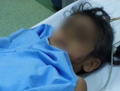 Samsun'da 4. Kattan Düşen Çocuk Ağır Yaralandı