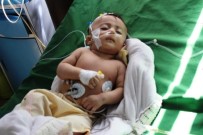 İÇ SAVAŞ - UNICEF Açıklaması '400 Binden Fazla Yemenli Çocuk, İleri Derecede Yetersiz Beslenme Sorunu Yaşıyor'