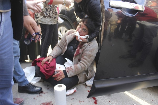 Kadının dilini kesti!