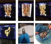 CASABLANCA - Midelerinde Ve Bağırsaklarında 400 Kapsül Uyuşturucuyla Havalimanında Yakalandılar