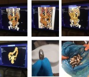 CASABLANCA - Şüphe Üzerine Çekilen Tomografi Gerçeği Ortaya Çıkardı