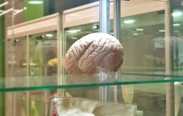GENETİK HASTALIKLAR - Beyin İmplantları Hafızayı Yüzde 20 Arttırıyor