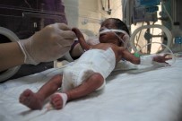 YOĞUN BAKIM ÜNİTESİ - Onlar 'El Bebeklerin' Ailesi
