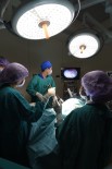 MİDE KANSERİ - Kanser Cerrahisinde 'Kapalı Yöntem' Yaygınlaşıyor