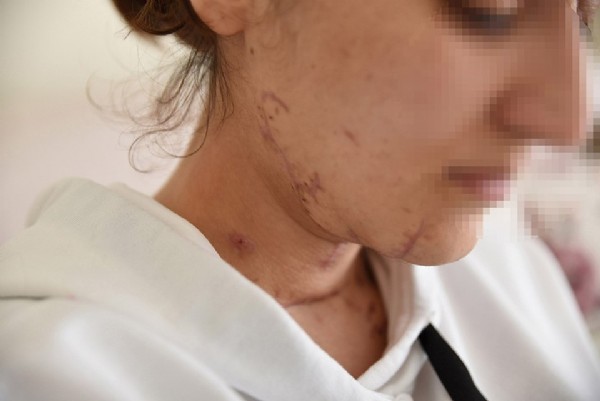 İstanbul'da genç kızın akıl almaz vahşetten mucize kurtuluşu