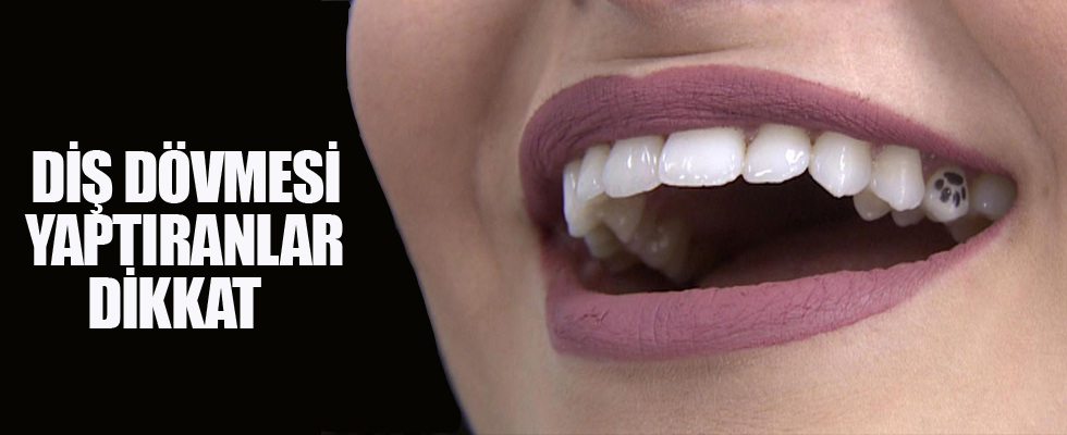 Diş dövmesi yaptıranlar dikkat