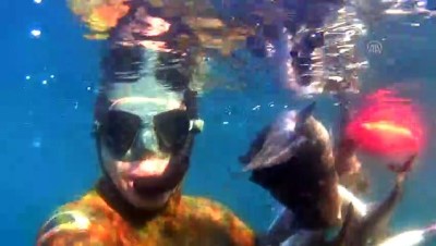 Kazada Bacaklarını Kaybetti, Sporla Hayata Tutundu