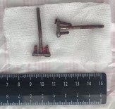 İMPLANT - Ağzından İmplant Yerine İnşaat Vidası Çıktı