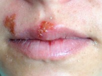 UYKUSUZLUK - Uçuğa El Sürmeyin