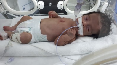 Bir Annenin Feryadı Açıklaması 'Bebeğimin Sesini Hiç Duymadım'