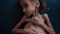 İNSANİ KRİZ - Yemen'de Kolera Salgını