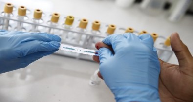 Rusya Açıklaması '38 Milyon Kişiye HIV Testi Yapıldı'
