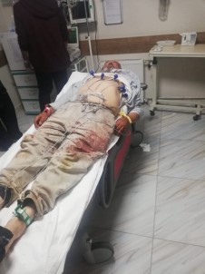 Karaman'da Besicilerin Mera Kavgası Kanlı Bitti Açıklaması 4 Yaralı