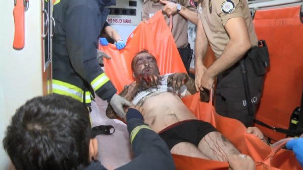 Hırsızın iş kazası...