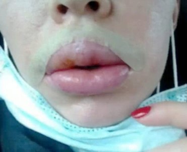 500 Kadını Mağdur Eden Sahte Güzellik Uzmanına Hapis Cezası