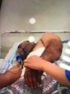 Ulu Cami'i Saldırısının Azmettiricisi Suriye'de Ağır Yaralandı