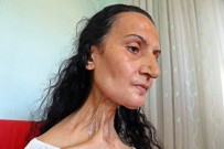 Dil Kanserine Yakalandı, Hayatları Karardı