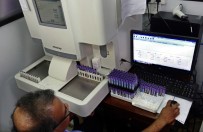 BAŞ DÖNMESİ - Sri Lanka'da Dang Humması Salgını Açıklaması 28 Ölü