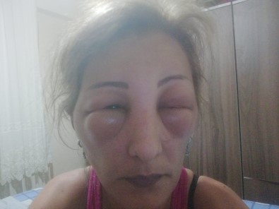 Saçlarını Yaptırmak İçin Kuaföre Gitti, Canından Oluyordu