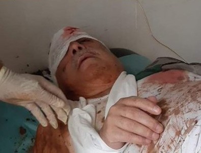 Lider kadrodaki terörist ağır yaralandı