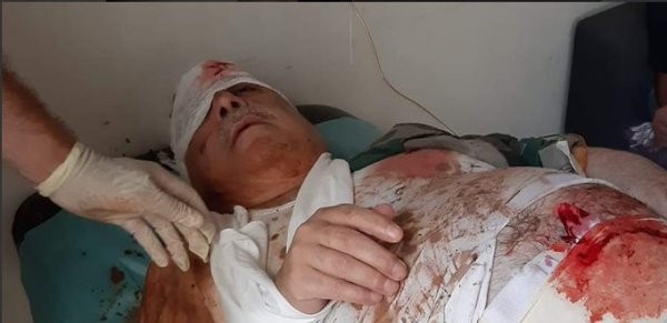 Lider kadrodaki terörist ağır yaralandı